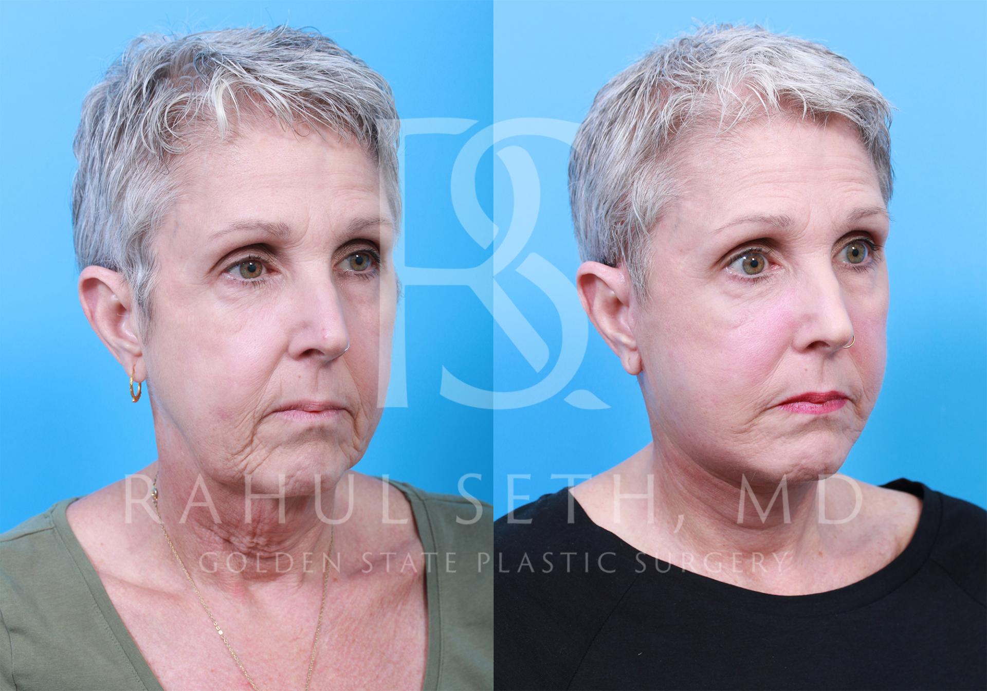 Rahul Seth, MD, FACS - Golden State Plastic Surgery